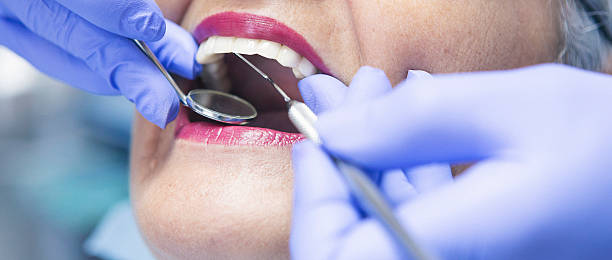 Best Urgent Care for Lost Fillings or Crowns in Cedaredge, CO